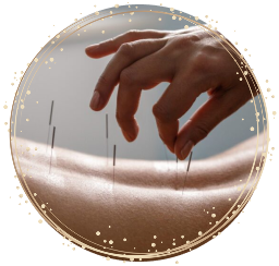 ACUPUNCTURE